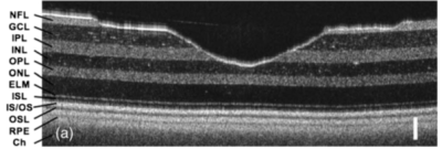 Retina phantom layers