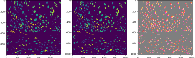 Image Genetration from Segmentation Mask