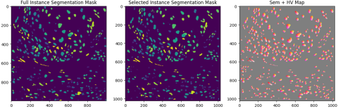 Image Genetration from Segmentation Mask